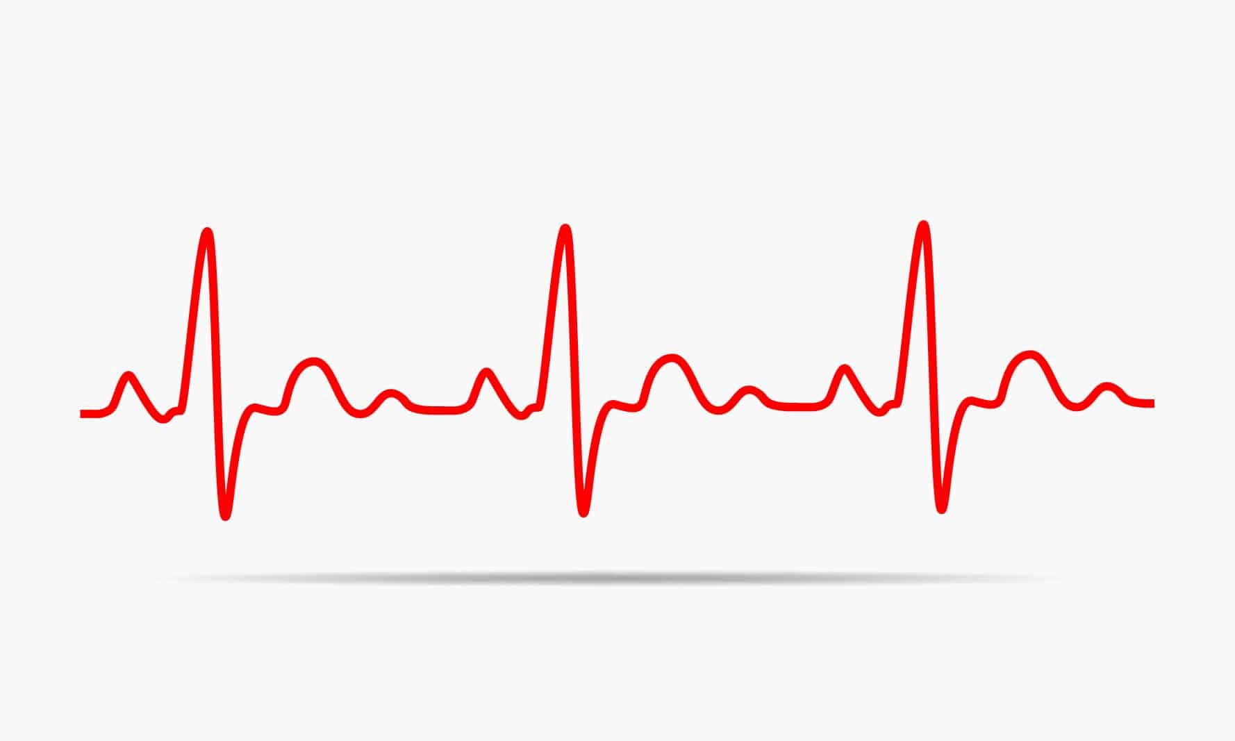 How to Optimize WordPress Heartbeat API Without A Plugin - SERT Media